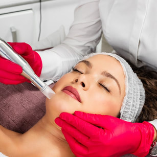 microneedling, fine lines and wrinkles